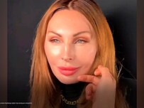 Наталья Бочкарева раскрыла результаты подтяжки лица у Тимура Хайдарова